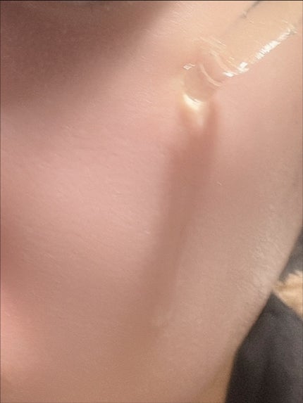 ナイアシンアミドブレミッシュケアセラム/ONE THING/美容液を使ったクチコミ(5枚目)