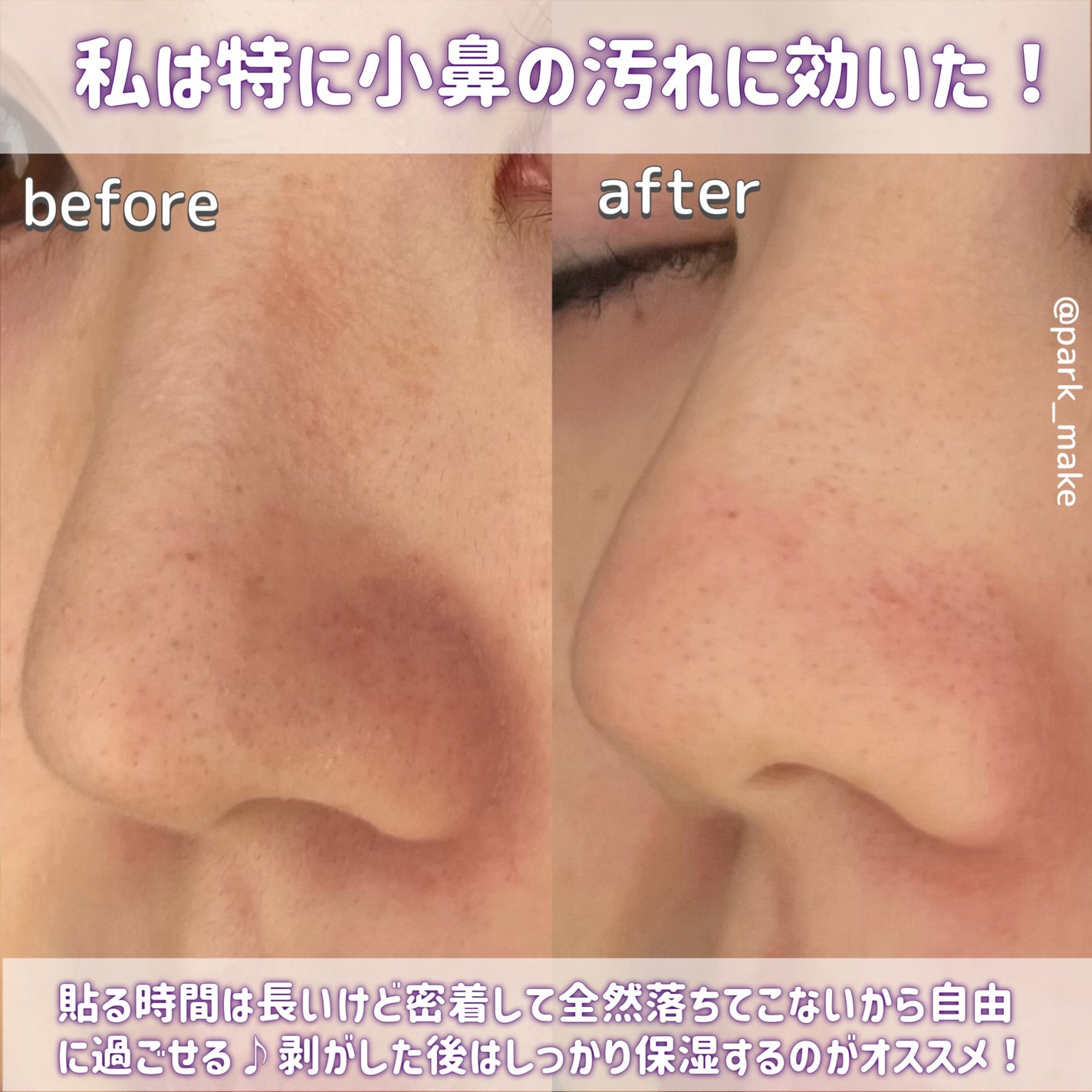 トラブルパッチマスク/EIOM/その他スキンケアを使ったクチコミ(5枚目)