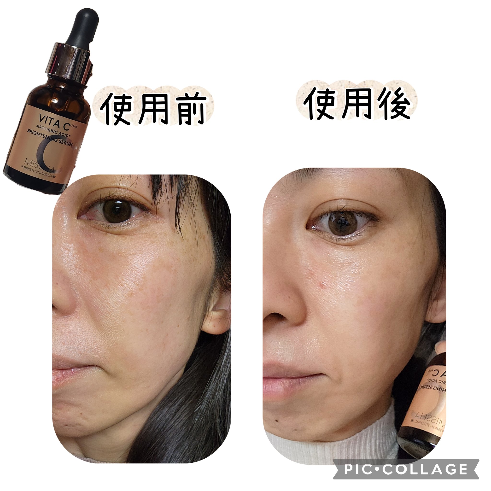 ミシャ ビタシープラス 薬用ブライトニング美容液/MISSHA/美容液を使ったクチコミ（3枚目）