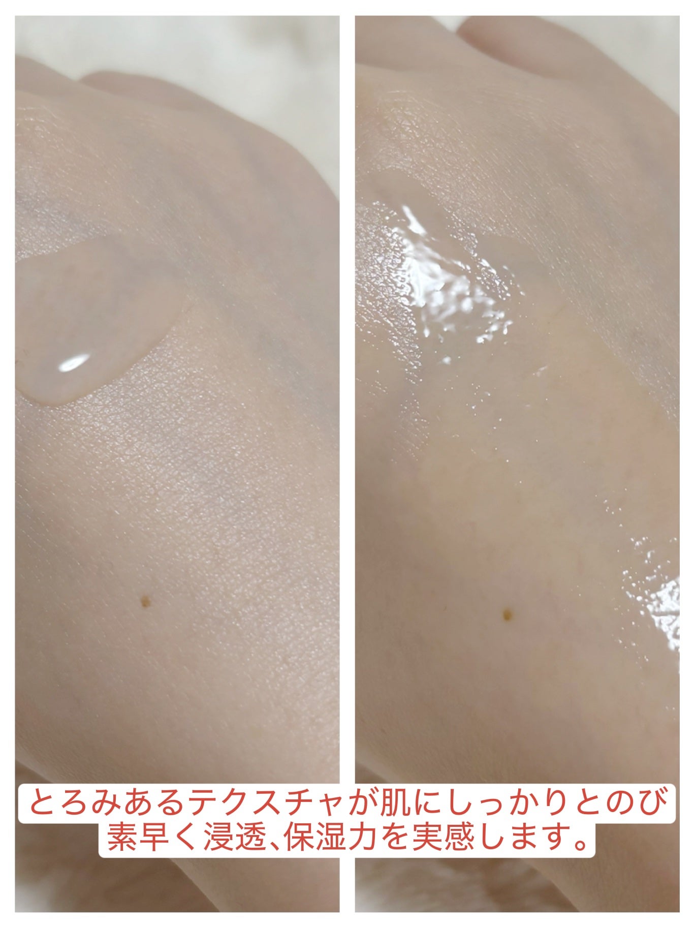 ノスカナイントラブルセラムS/FATION/美容液を使ったクチコミ(3枚目)