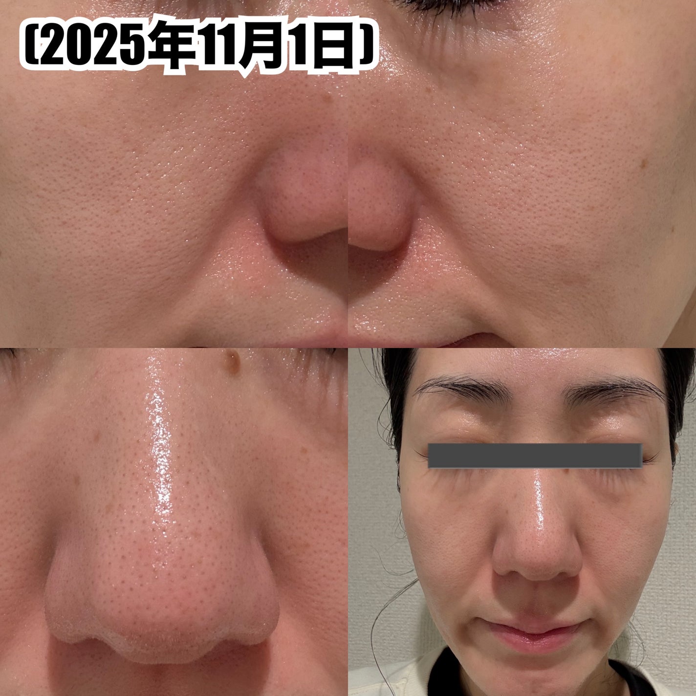 ダーマエイド トリプルアクティブエッセンス【医薬部外品】/pdc/美容液を使ったクチコミ(4枚目)