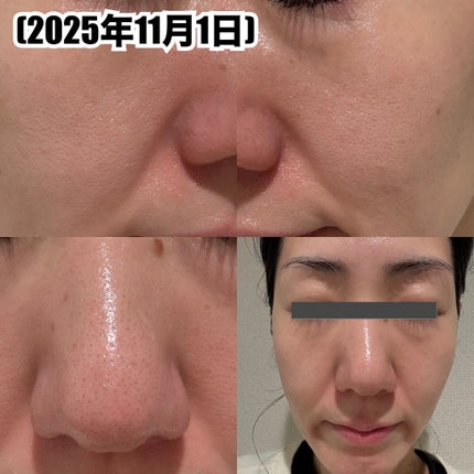 ダーマエイド トリプルアクティブエッセンス【医薬部外品】/pdc/美容液を使ったクチコミ(4枚目)