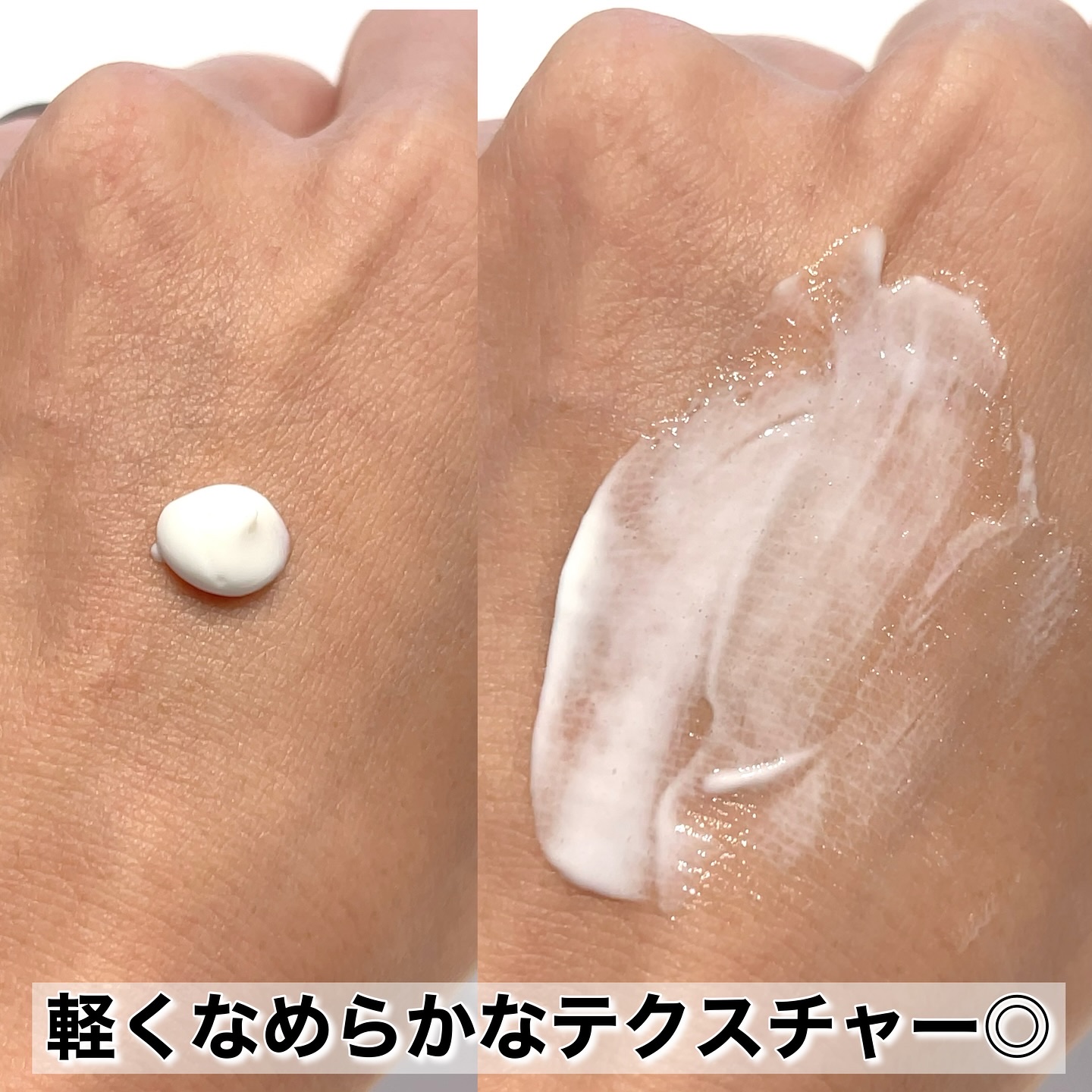 PDRN+リードルS 100/VT/美容液を使ったクチコミ（3枚目）