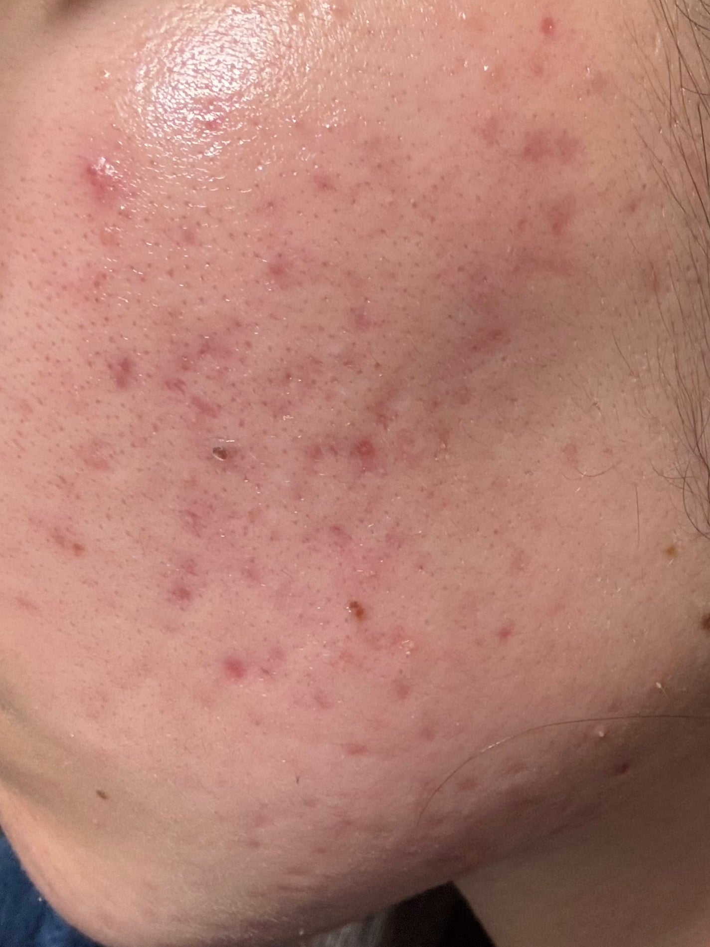 ãããð on LIPS ãèããŠããŸã£ãð..ãïŒ2æç®ïŒ