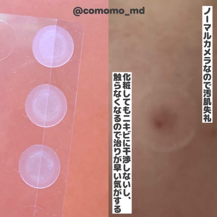 プロCICA クリアスポットパッチ/VT/その他スキンケアを使ったクチコミ(2枚目)