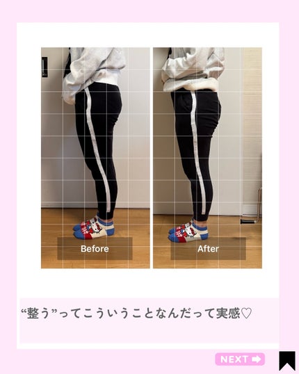 Kana on LIPS 「【産後ケア・姿勢ケアにおすすめ🕊️】骨盤調整×骨盤底筋トレーニ..」(6枚目)