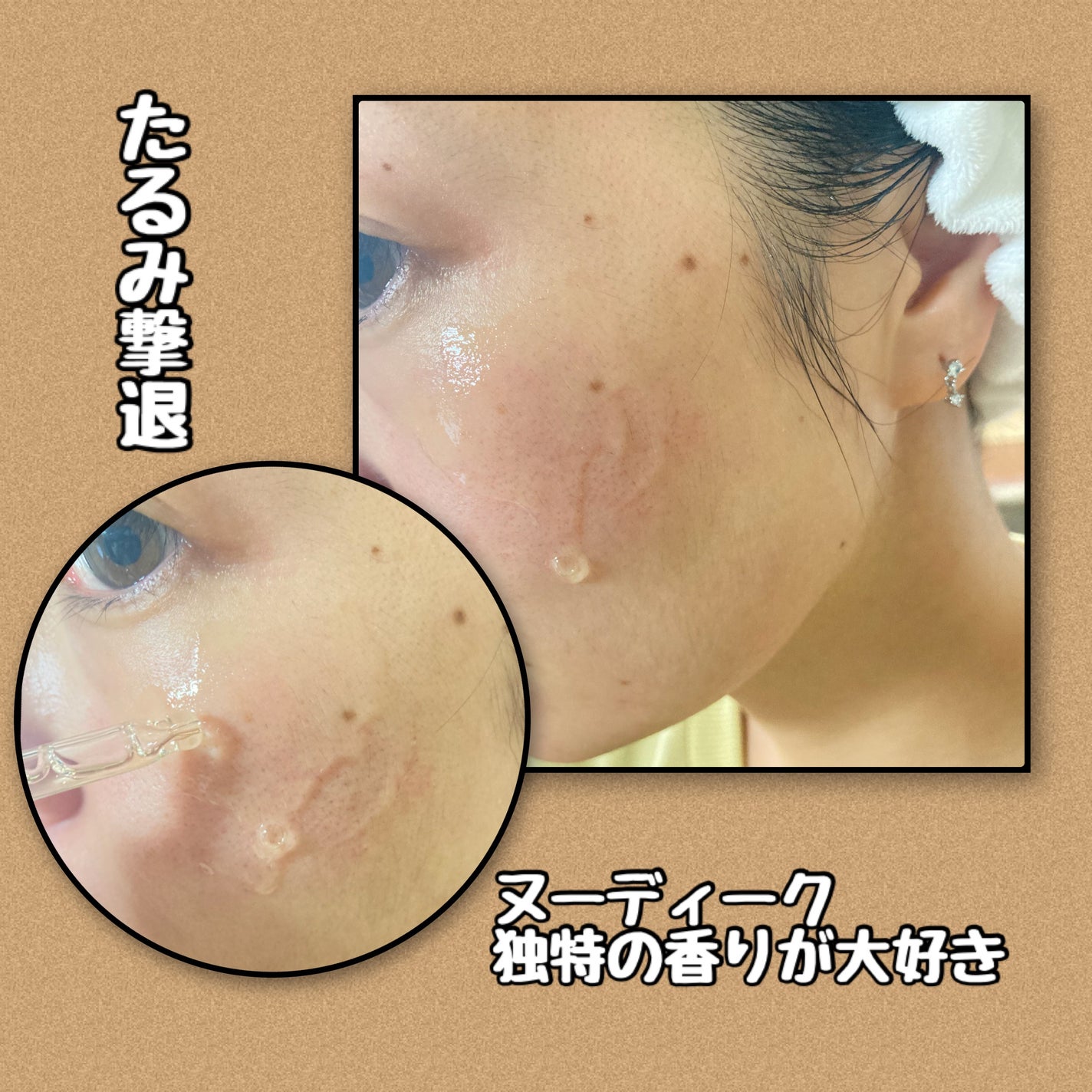 スピテラパーミアPDRNアンプル/NUDIQUE/美容液を使ったクチコミ(3枚目)