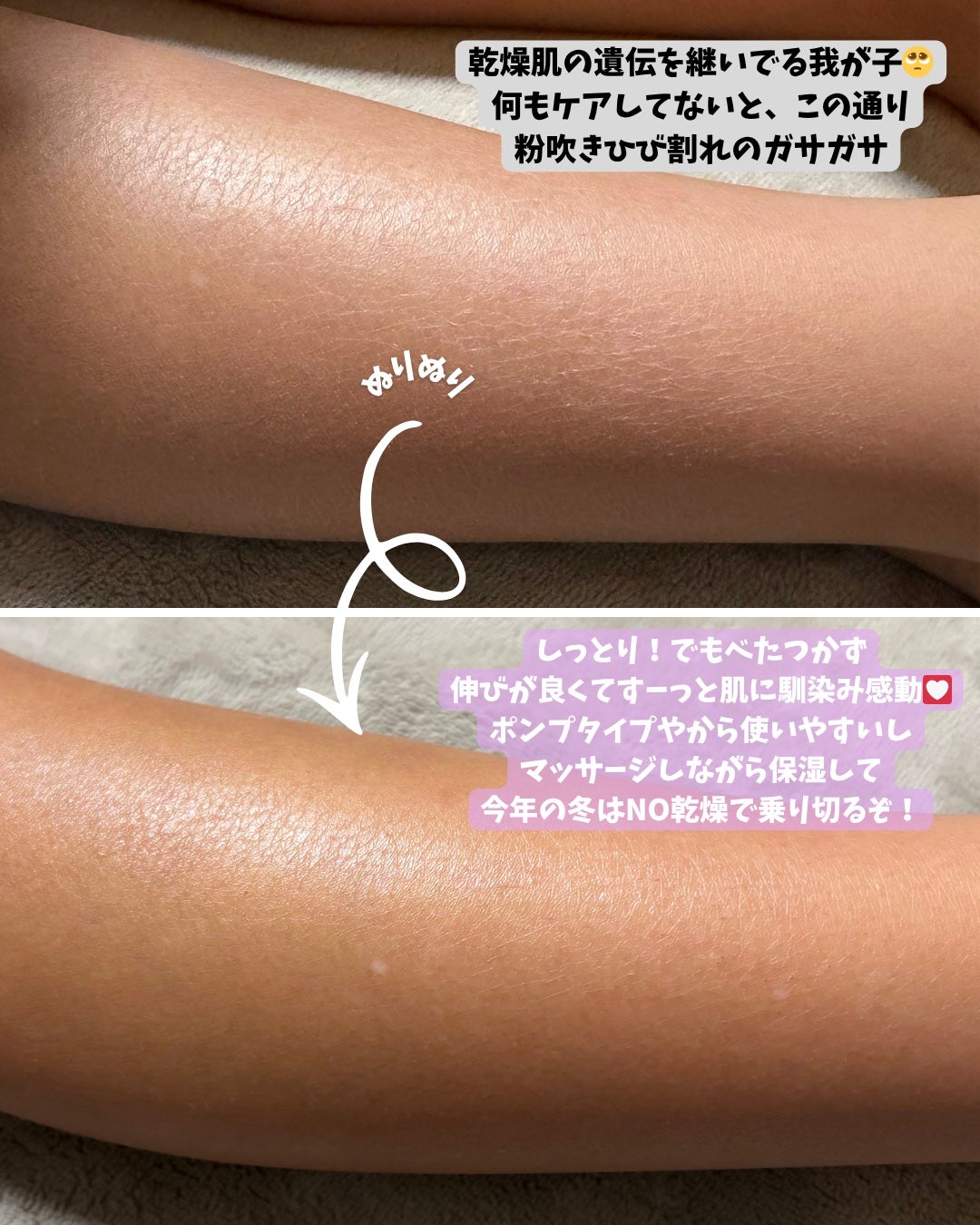 ノルウェー フォーミュラ インテンスリペア ボディ エマルジョン/Neutrogena/ボディローションを使ったクチコミ(3枚目)