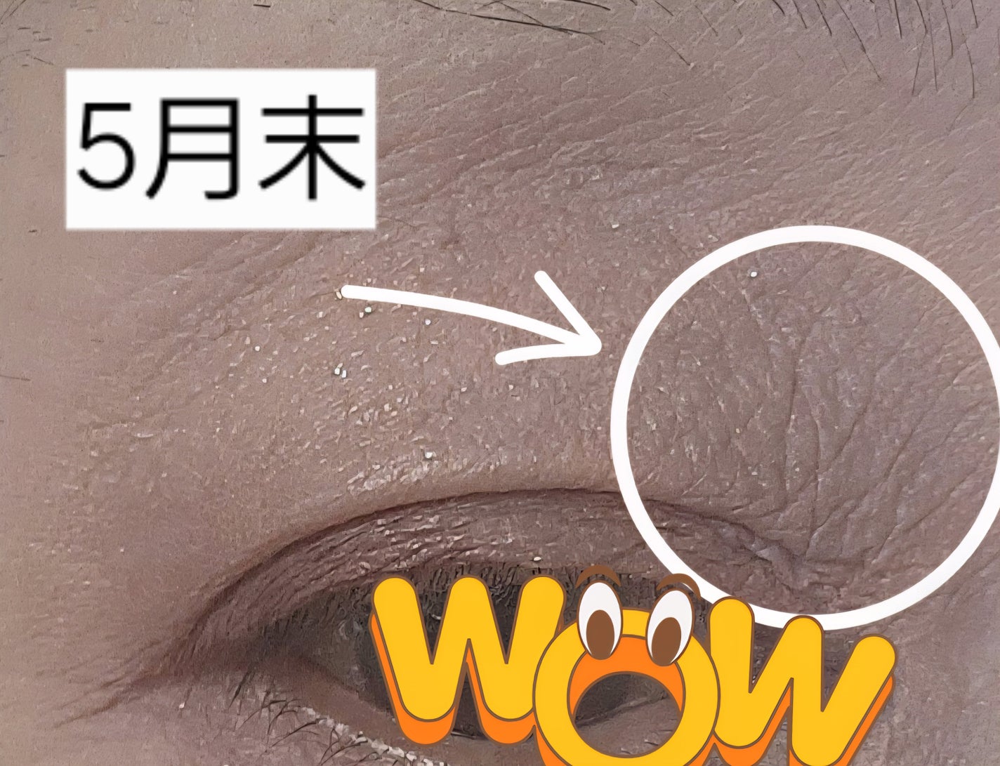 @mieeee4 on LIPS 「目蓋の目頭側に老人らしいwシワがあってまぁそういう年齢だしな😑..」(2枚目)