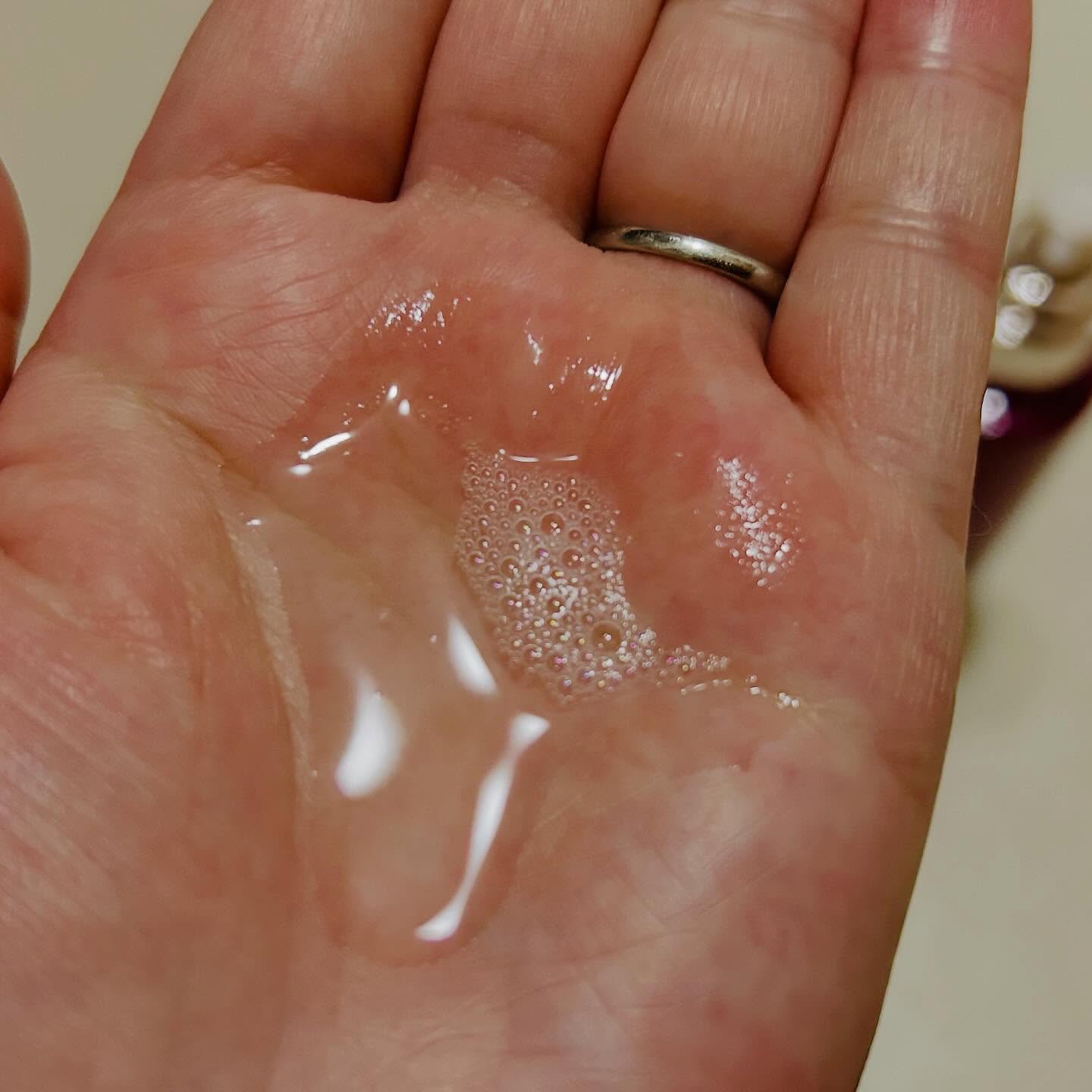 トワニー ローションN II/TWANY/化粧水を使ったクチコミ（2枚目）