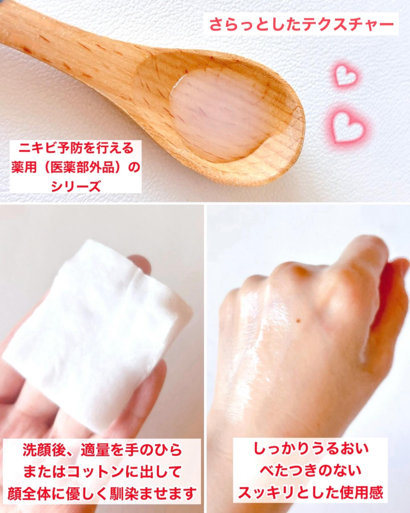 薬用化粧水/スキンライフ/化粧水を使ったクチコミ（2枚目）