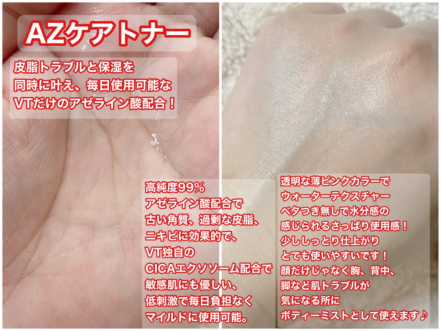 AZケア マスク/VT/シートマスク・パックを使ったクチコミ(2枚目)