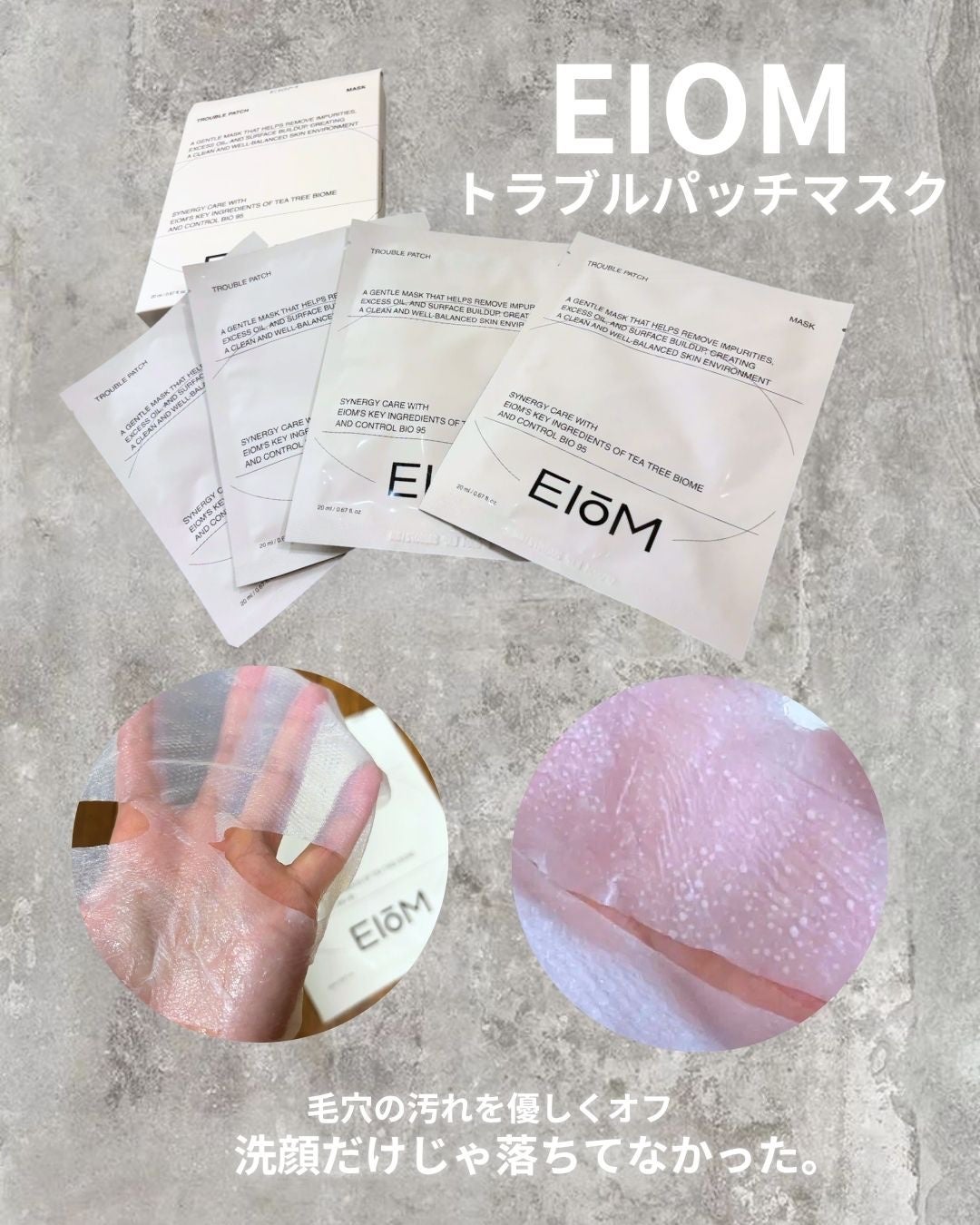 トラブルパッチマスク/EIOM/その他スキンケアを使ったクチコミ(2枚目)