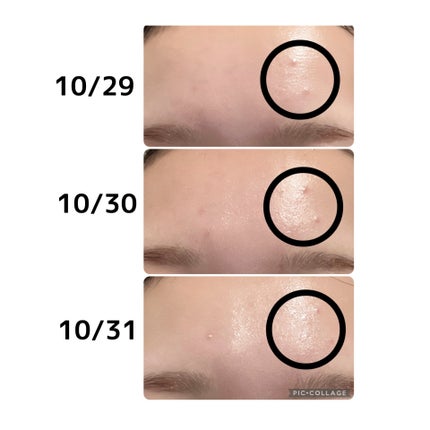 SOSメルダーシステム/KOPHER/フェイスクリームを使ったクチコミ(3枚目)