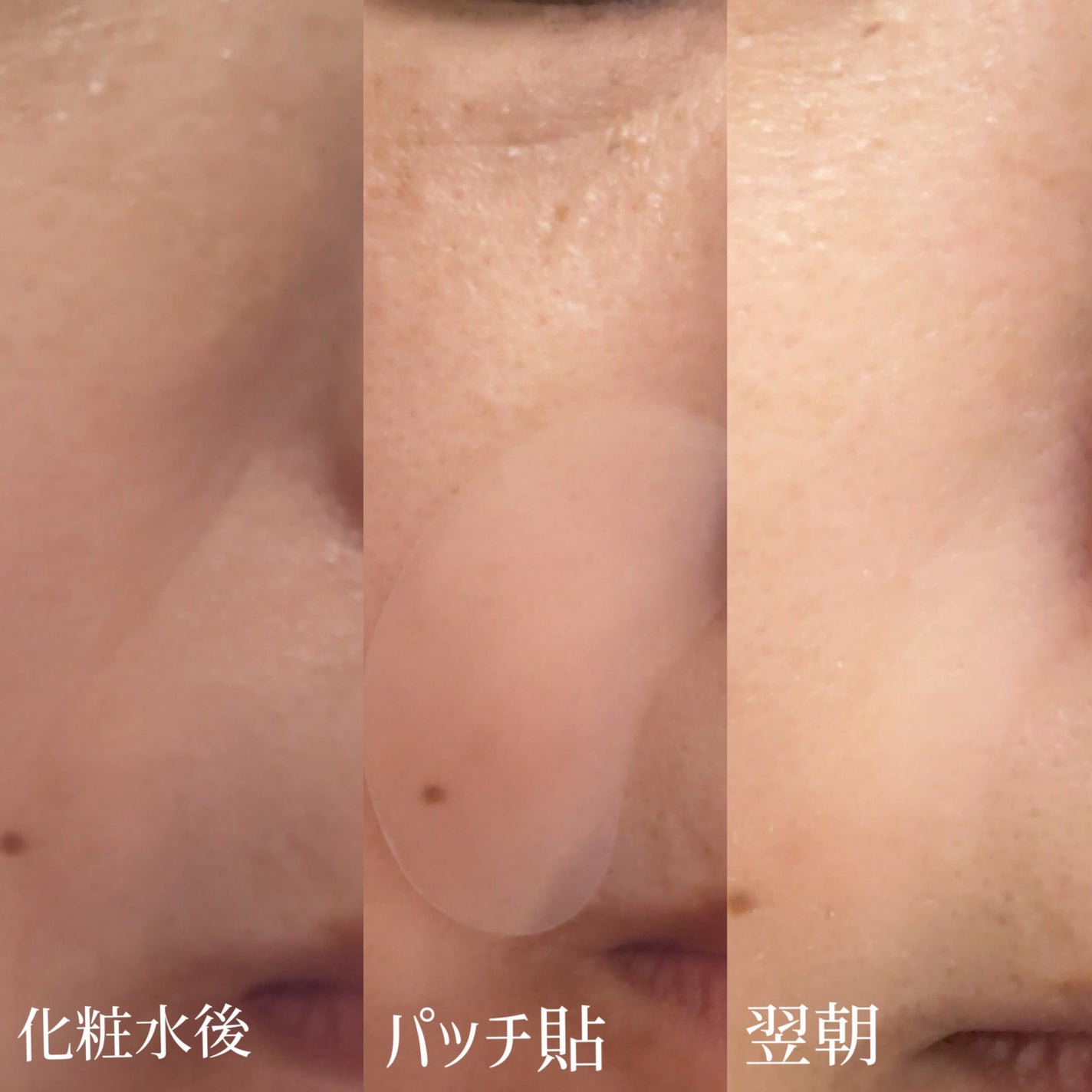 リンクルリペアしわパッチ/MARSHIQUE/その他スキンケアを使ったクチコミ(4枚目)