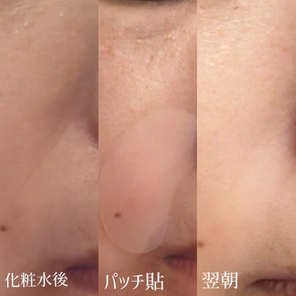 リンクルリペアしわパッチ/MARSHIQUE/その他スキンケアを使ったクチコミ(4枚目)