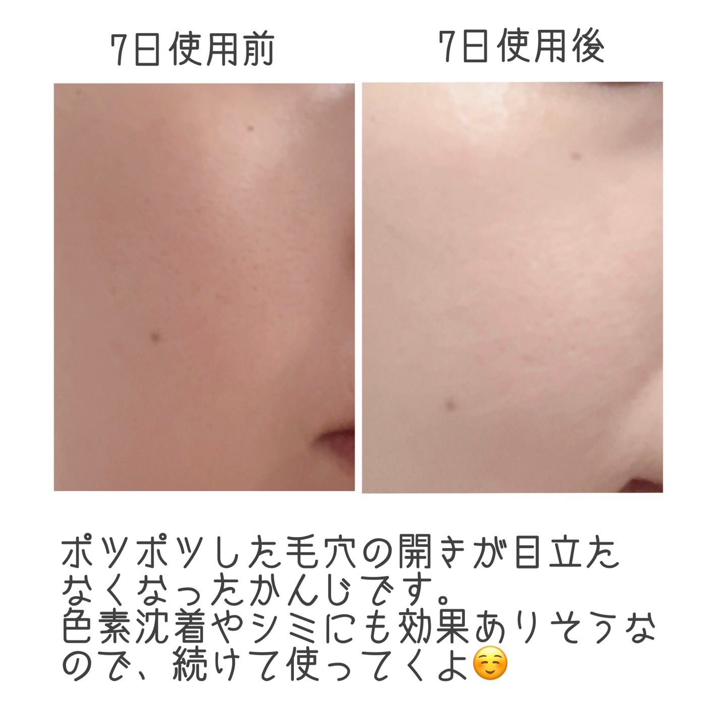 ビタシープラス 化粧水/MISSHA/化粧水を使ったクチコミ(4枚目)