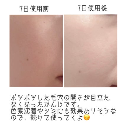 ビタシープラス 化粧水/MISSHA/化粧水を使ったクチコミ(4枚目)