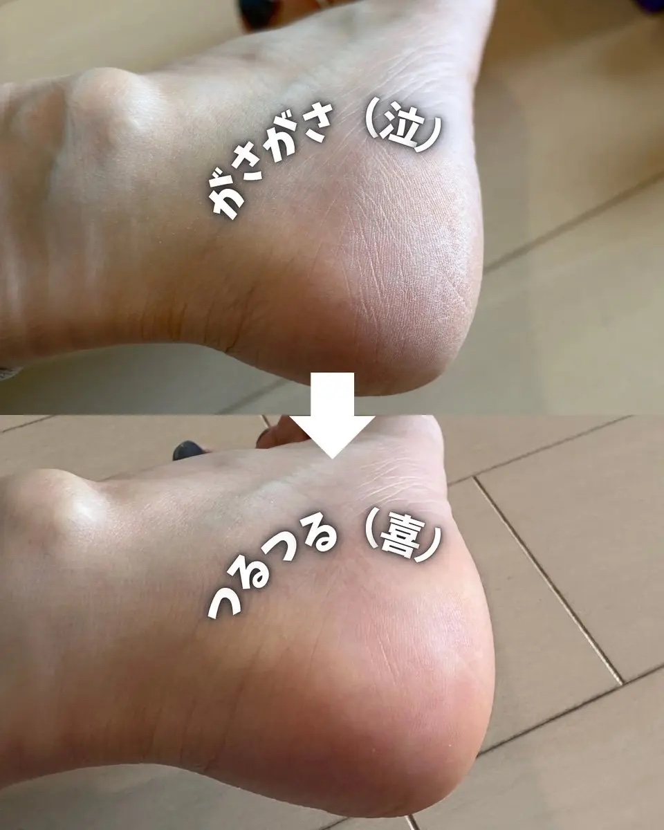 フットケアセット/BAREN/その他キットセットを使ったクチコミ（2枚目）