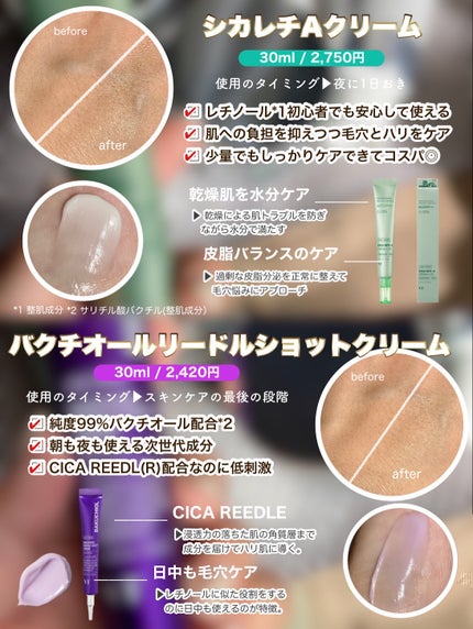 ã¿ããŸðãã©ãã100% on LIPS ãéãæ¯ç©Žã«äœ¿ããã6éžðïŒä»ã誰ããç¥ãVTâšãããªVTã®ç¹..ãïŒ4æç®ïŒ