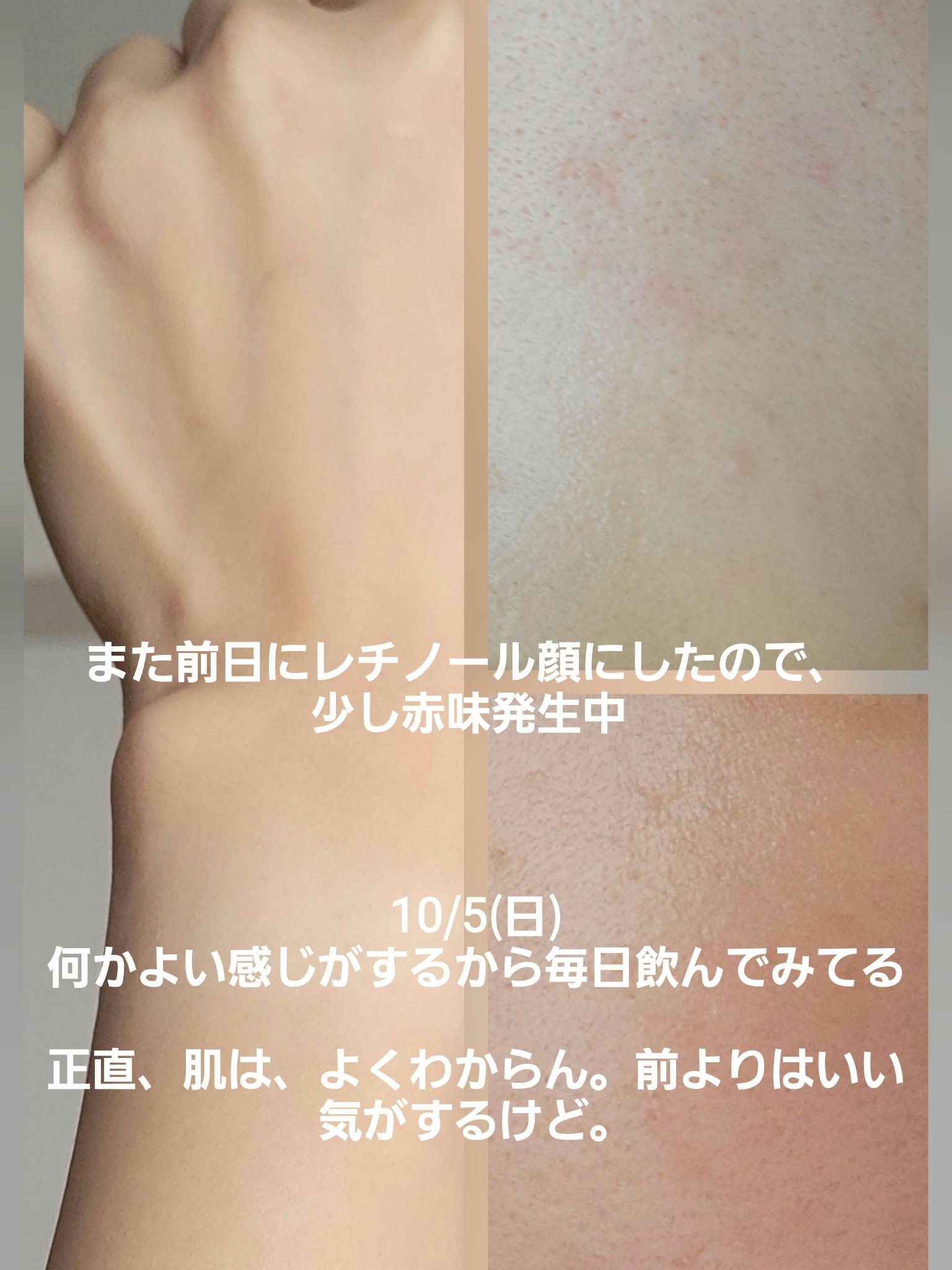 リポソーム生ビタミンC/Yunth/美容サプリメントを使ったクチコミ（2枚目）