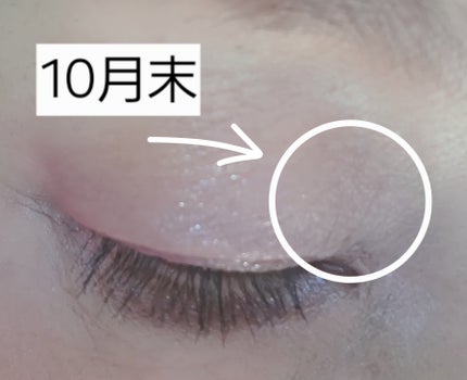 @mieeee4 on LIPS 「目蓋の目頭側に老人らしいwシワがあってまぁそういう年齢だしな😑..」(3枚目)