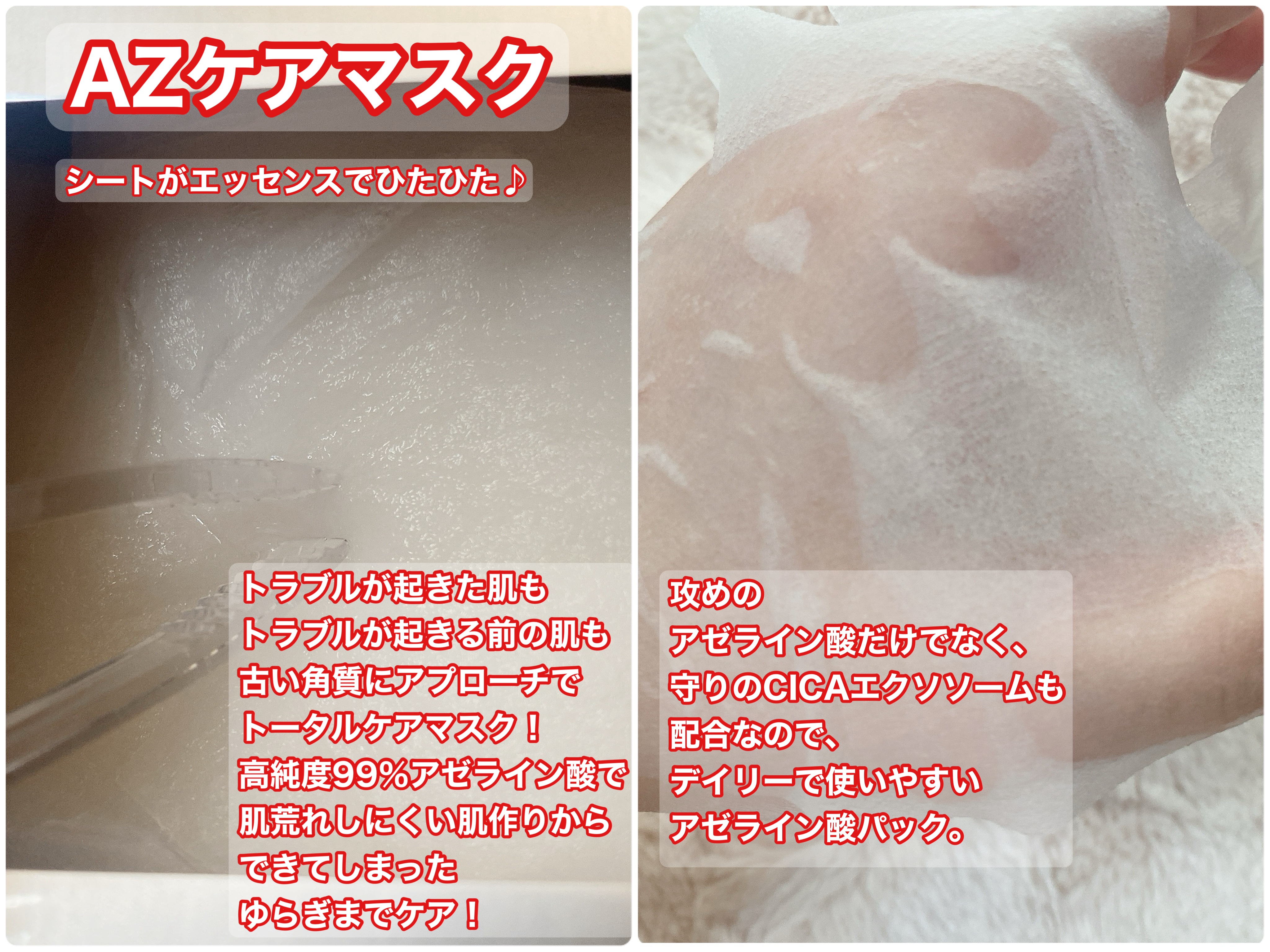 AZケア マスク/VT/シートマスク・パックを使ったクチコミ（3枚目）