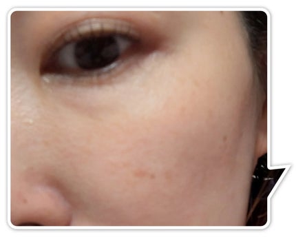 KOMFYMED® コラーゲン美容液 1.5ml×5本セット/KOMFYMED/美容液の画像