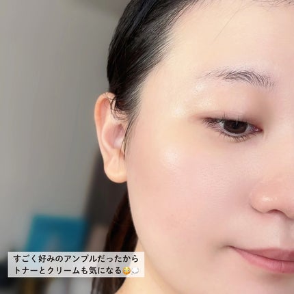 ReDRNエクソソームアンプル/Dr.nineteen/美容液を使ったクチコミ(5枚目)