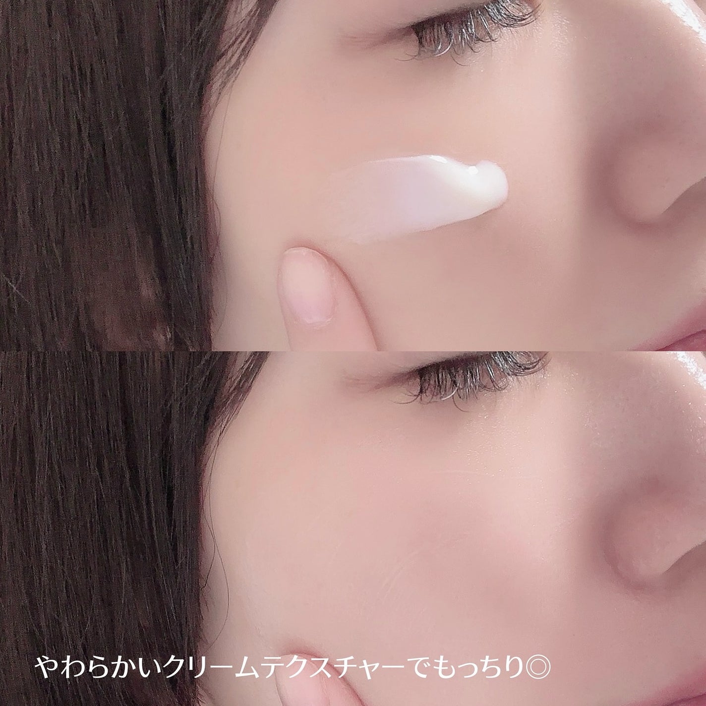 PDRN+リードルS 100/VT/美容液を使ったクチコミ(3枚目)