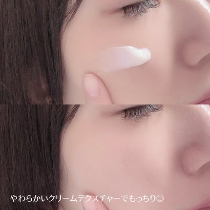 PDRN+リードルS 100/VT/美容液を使ったクチコミ(3枚目)