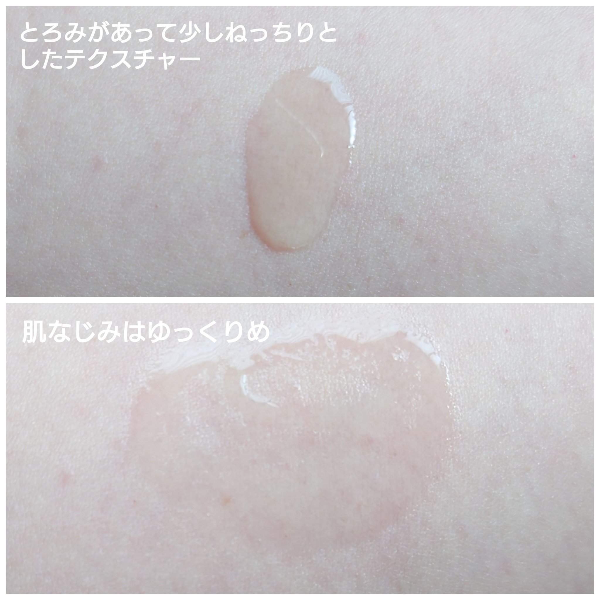 シナールエクシア ホワイトメディカルローション/シオノギ製薬/化粧水を使ったクチコミ（2枚目）