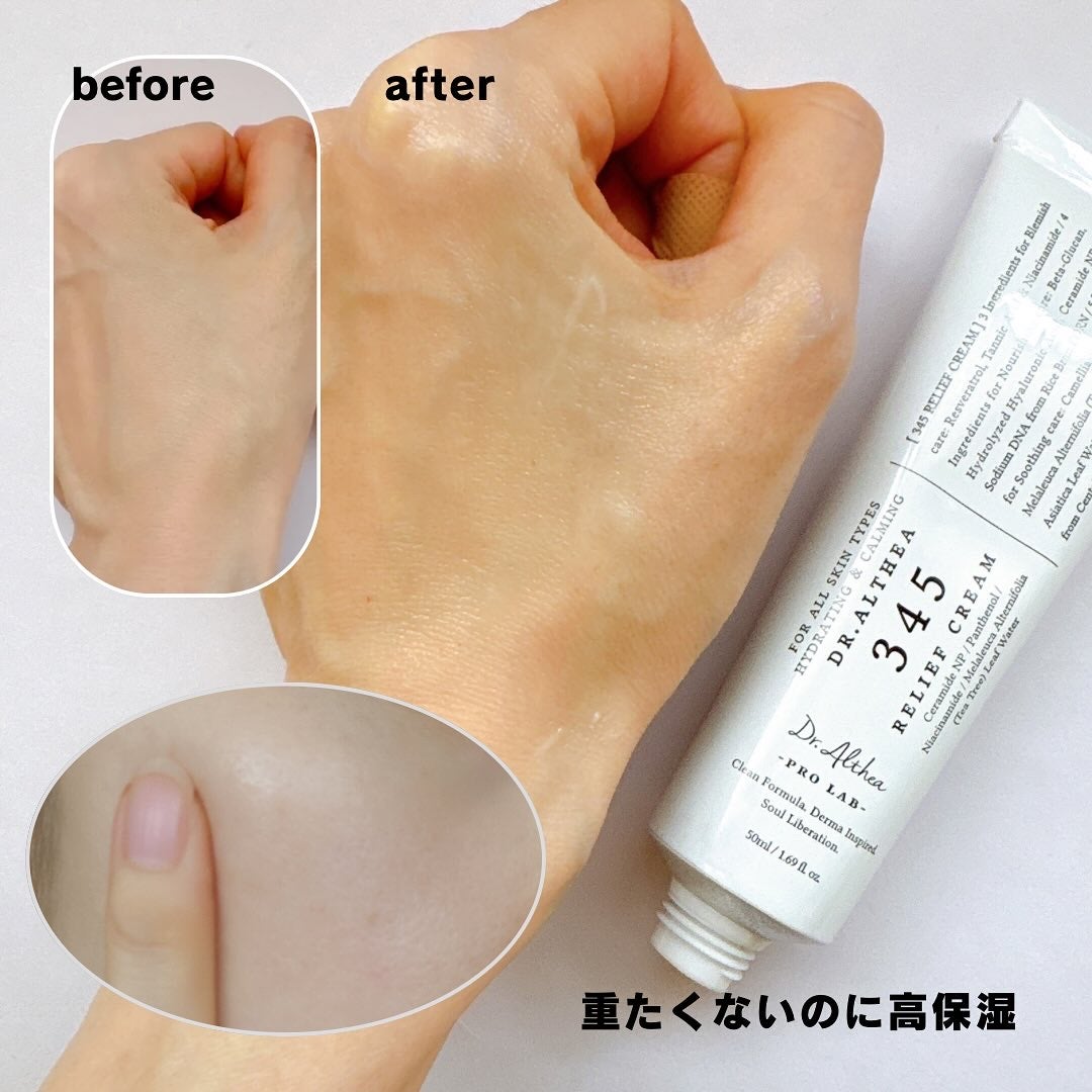 345リリーフクリーム/Dr.Althea/フェイスクリームを使ったクチコミ(4枚目)