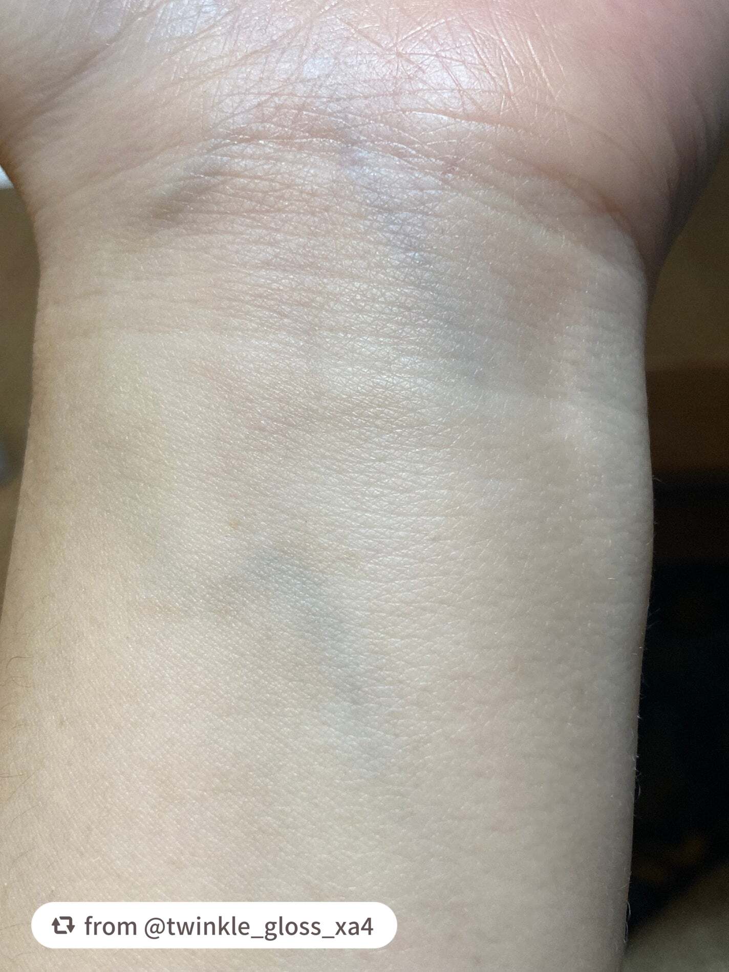 REJURAN デュアルエフェクトアンプル 30ml/REJURAN COSMETICS/美容液を使ったクチコミ(10枚目)