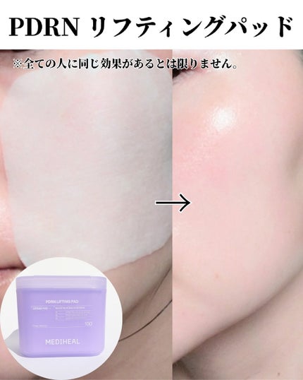 マデカソサイド ブレミッシュパッド/MEDIHEAL/トナーパッドを使ったクチコミ(3枚目)