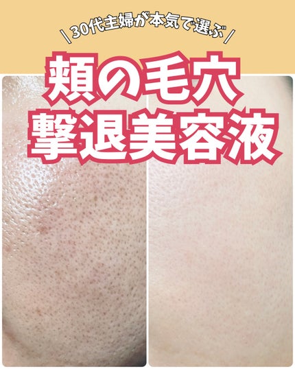 オバジC10セラム/オバジ/美容液を使ったクチコミ(1枚目)