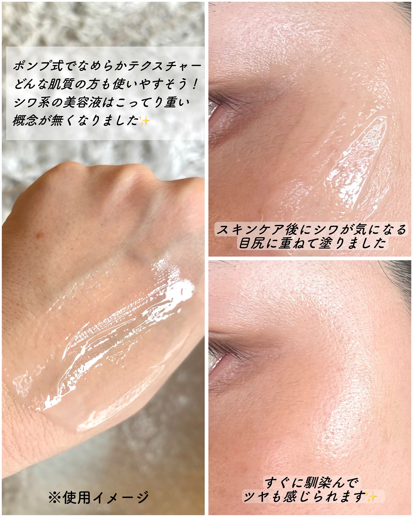 アットクリニックリンクルショットアンプル/DOMINAS/美容液を使ったクチコミ（3枚目）