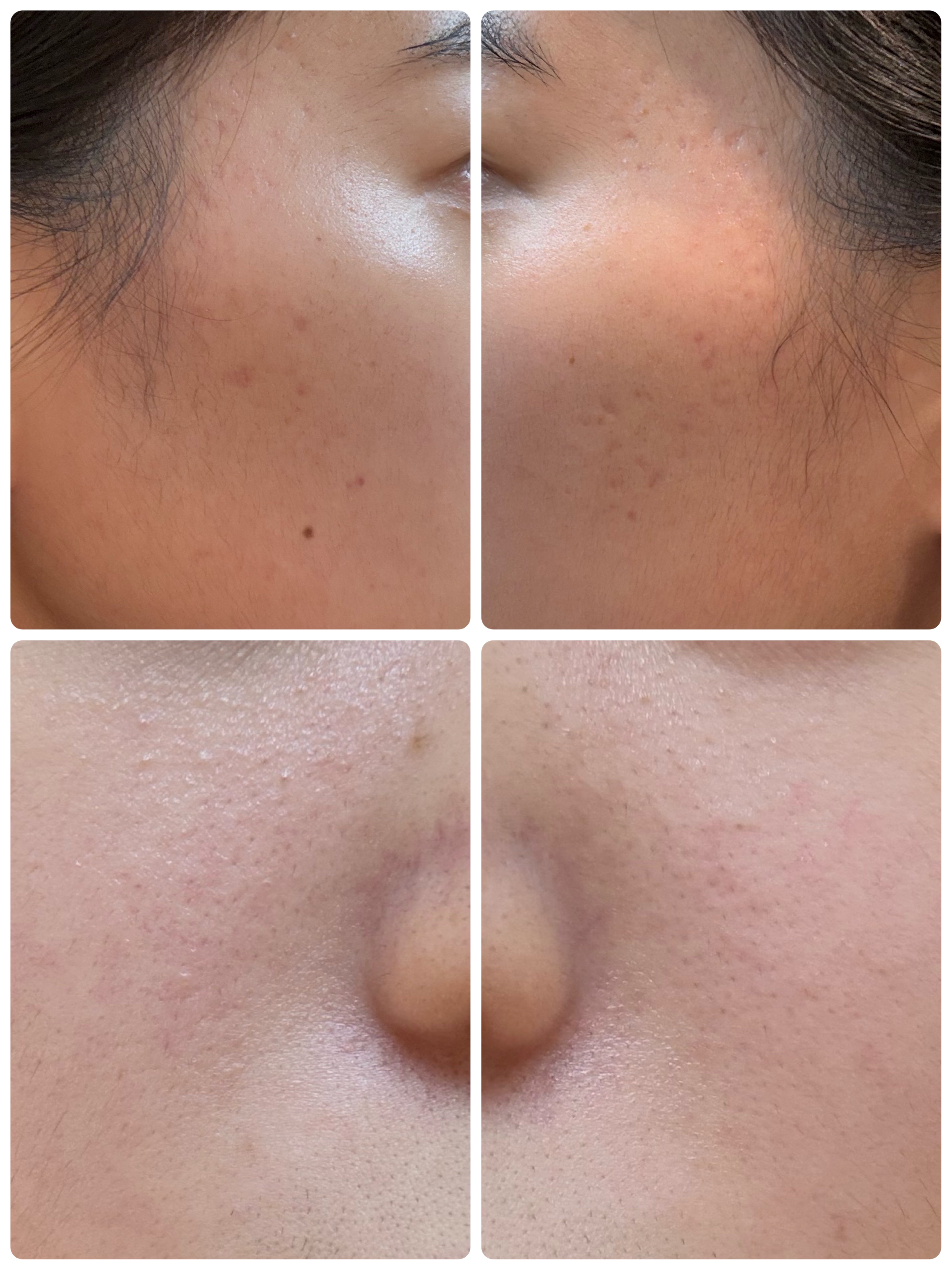 GLAM UP炭酸泡クレイマスク/GLAM UP/洗い流すパック・マスクを使ったクチコミ（2枚目）