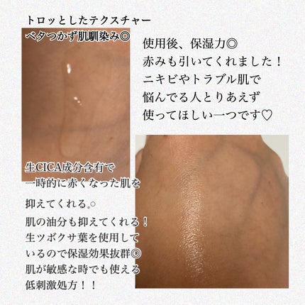 ノスカナイン トラブル セラム/FATION/美容液を使ったクチコミ(2枚目)