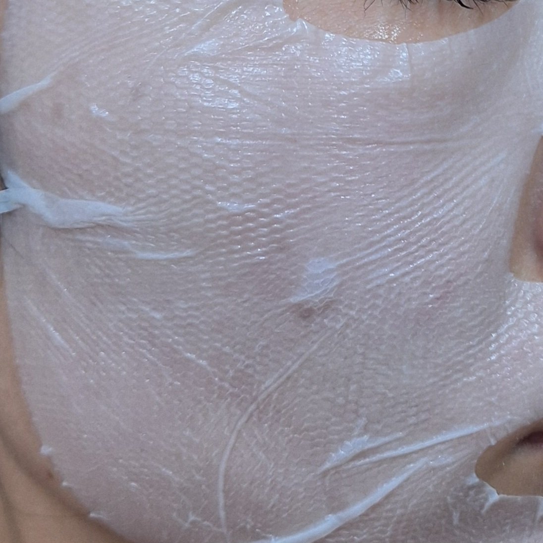 トラブルパッチマスク/EIOM/その他スキンケアを使ったクチコミ（3枚目）