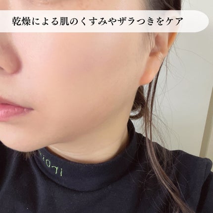 ミシャ ビタシープラス 美容液【日本処方】/MISSHA/美容液を使ったクチコミ(4枚目)