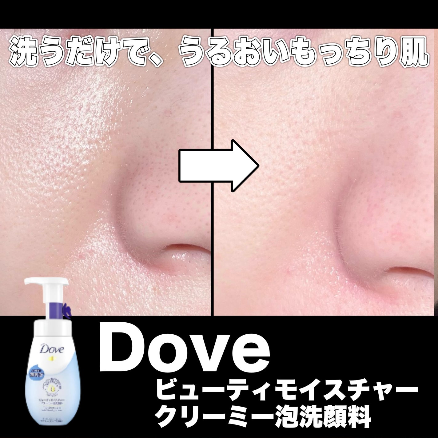 ビューティモイスチャー クリーミー泡洗顔料/ダヴ/泡洗顔を使ったクチコミ(1枚目)