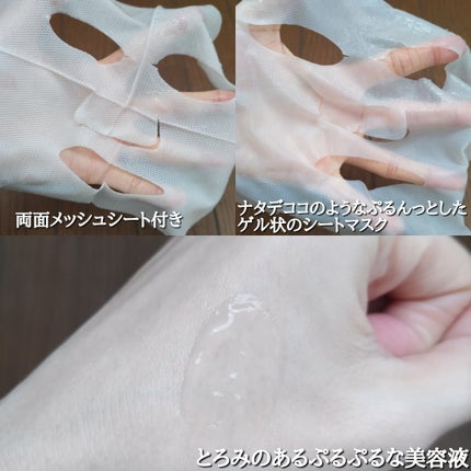 トラブルパッチマスク/EIOM/その他スキンケアを使ったクチコミ(5枚目)