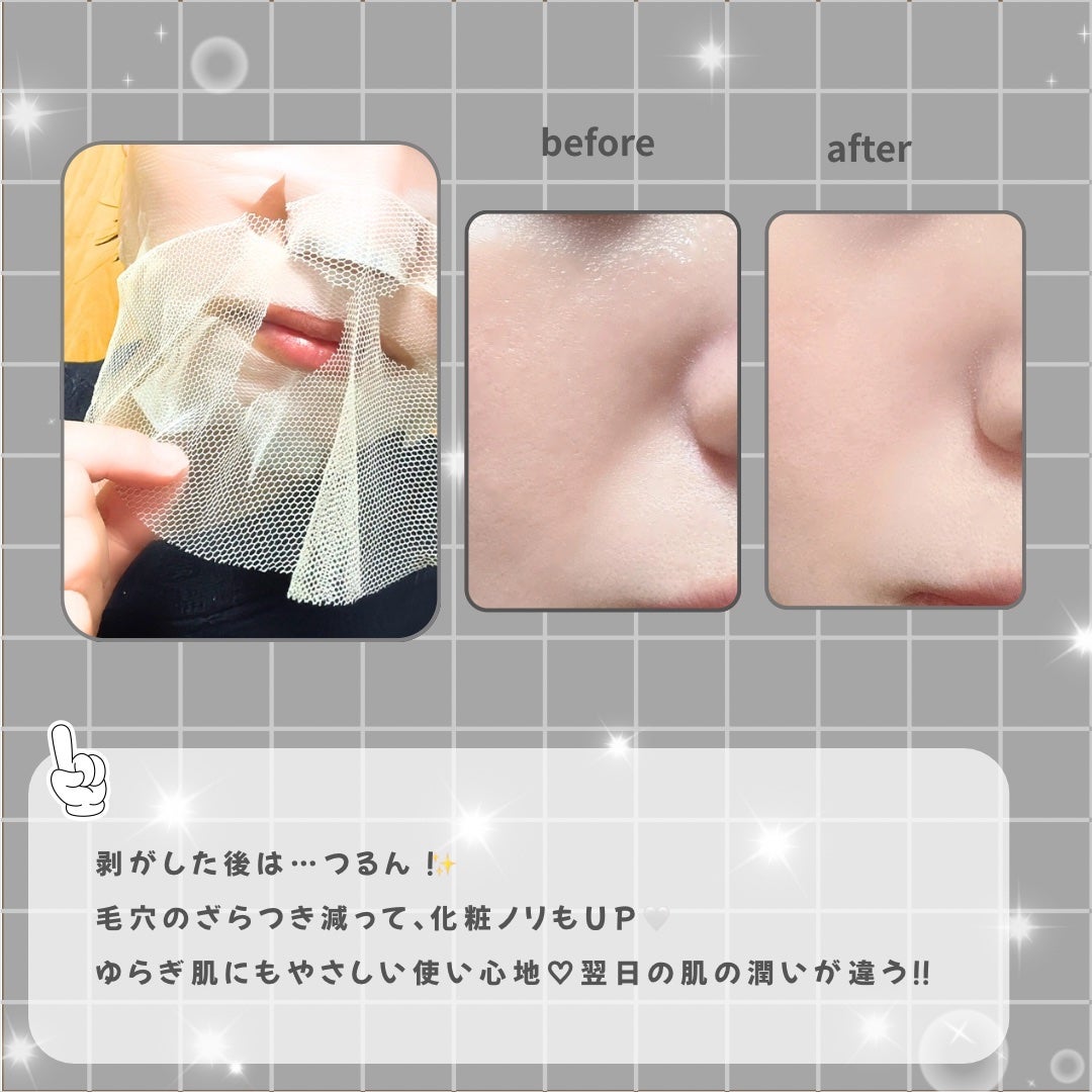 トラブルパッチマスク/EIOM/その他スキンケアを使ったクチコミ(3枚目)