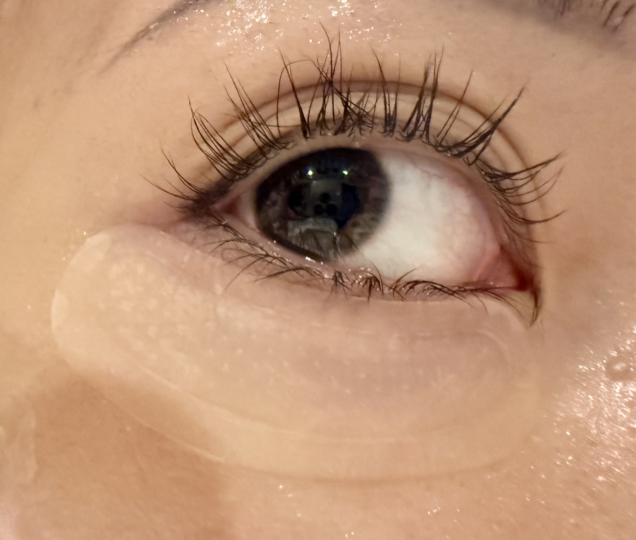 RETINOL PATCH ORIGINAL/ACROPASS/シートマスク・パックを使ったクチコミ（2枚目）