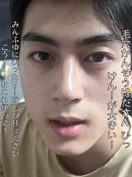 アネトス バランシング トリートメントクリーム/Anetos/フェイスクリームを使ったクチコミ(1枚目)