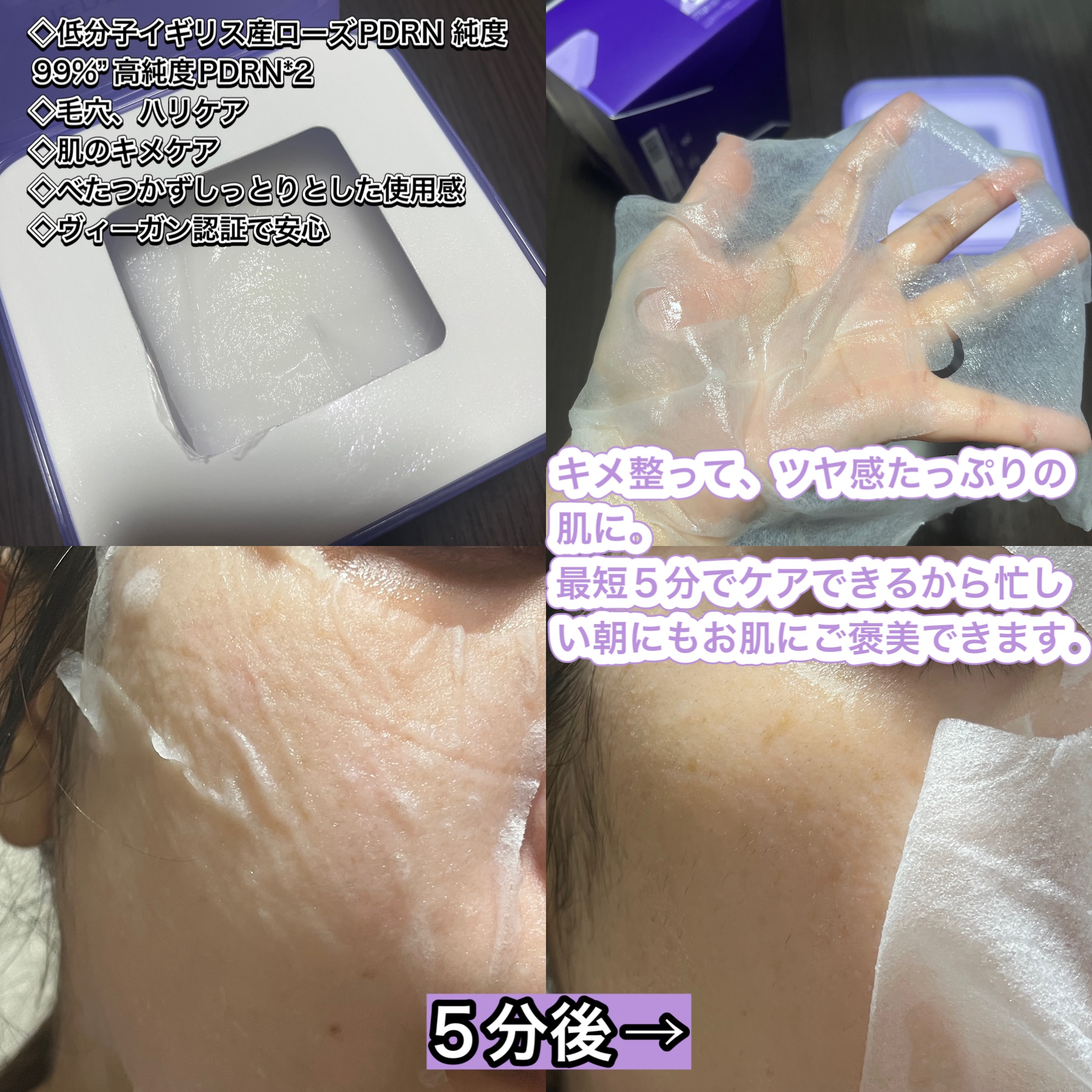 PDRN リフティングマスク/MEDIHEAL/シートマスク・パックを使ったクチコミ（2枚目）