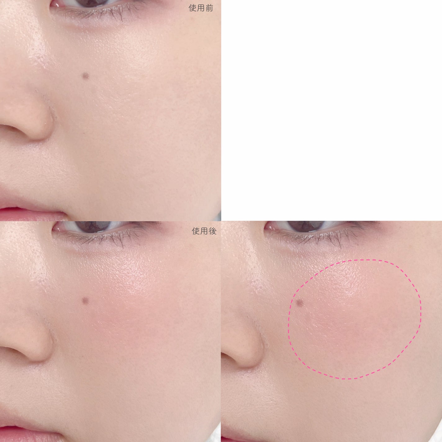 ボンボングロウチーク/Dear.A/リキッドチークを使ったクチコミ(5枚目)