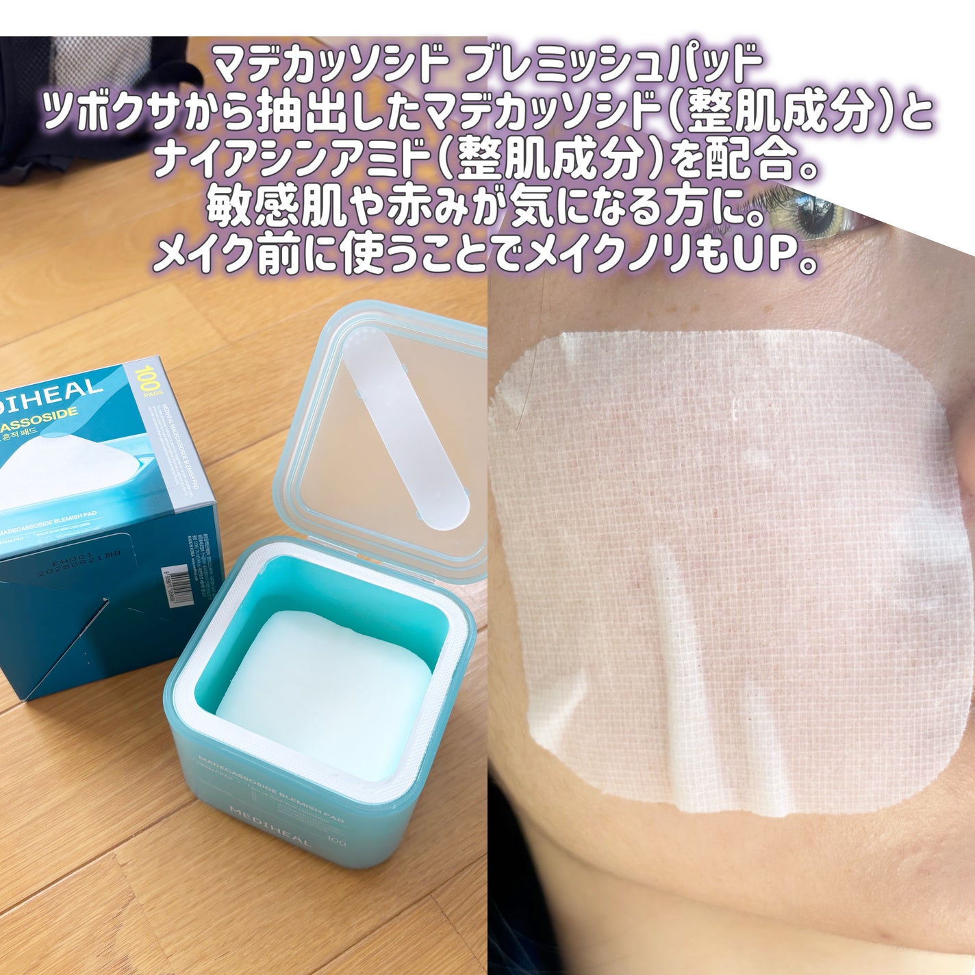 マデカソサイド ブレミッシュパッド/MEDIHEAL/トナーパッドを使ったクチコミ(3枚目)