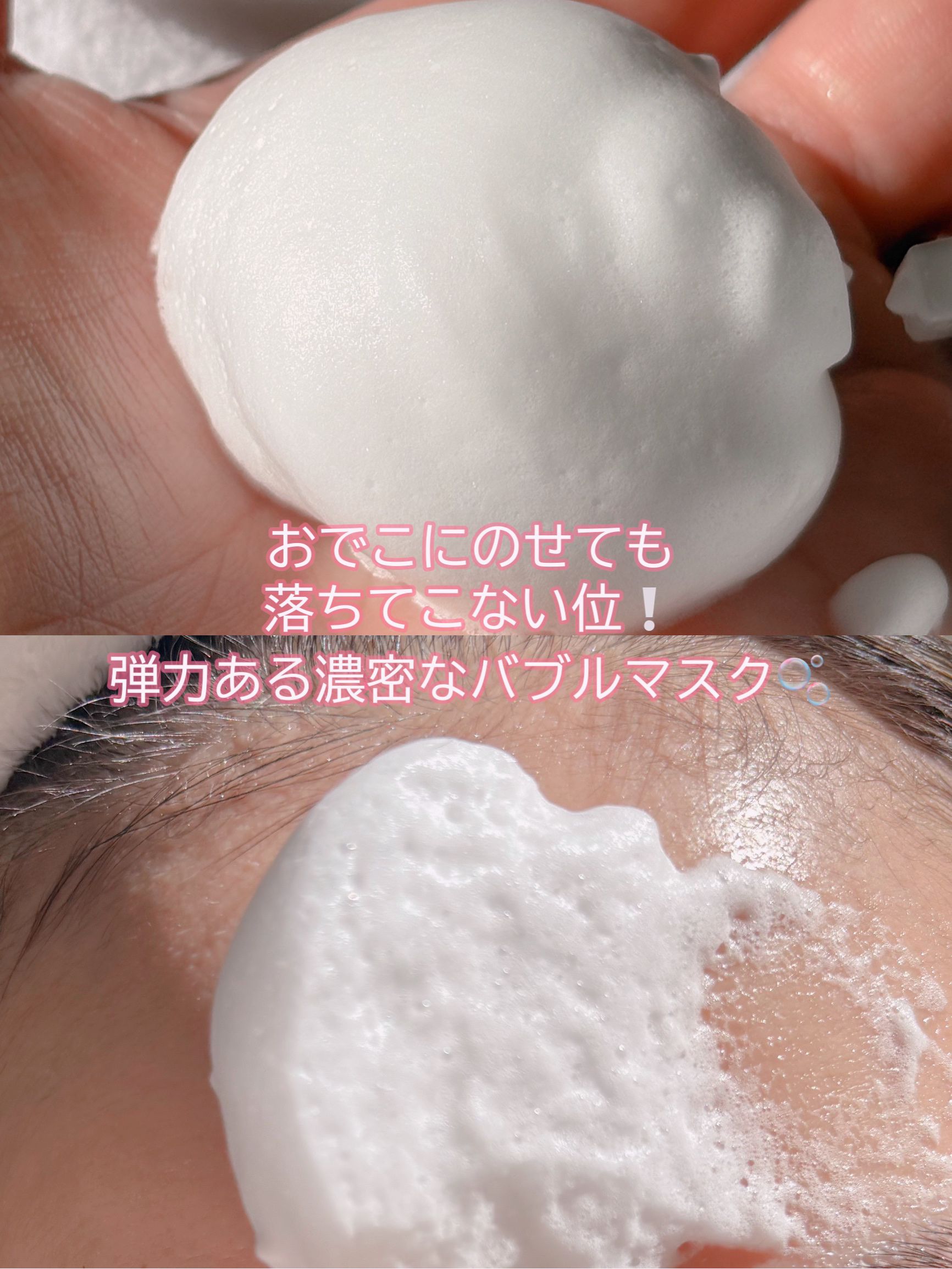 エアバブルCDSマスク/GASH/洗い流すパック・マスクを使ったクチコミ（2枚目）